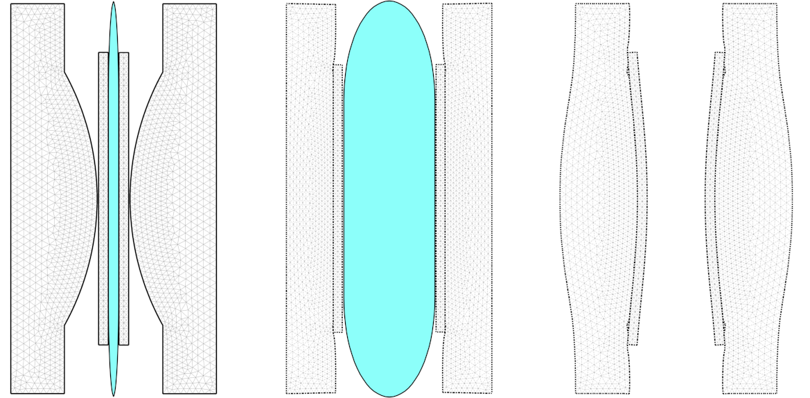 image stent